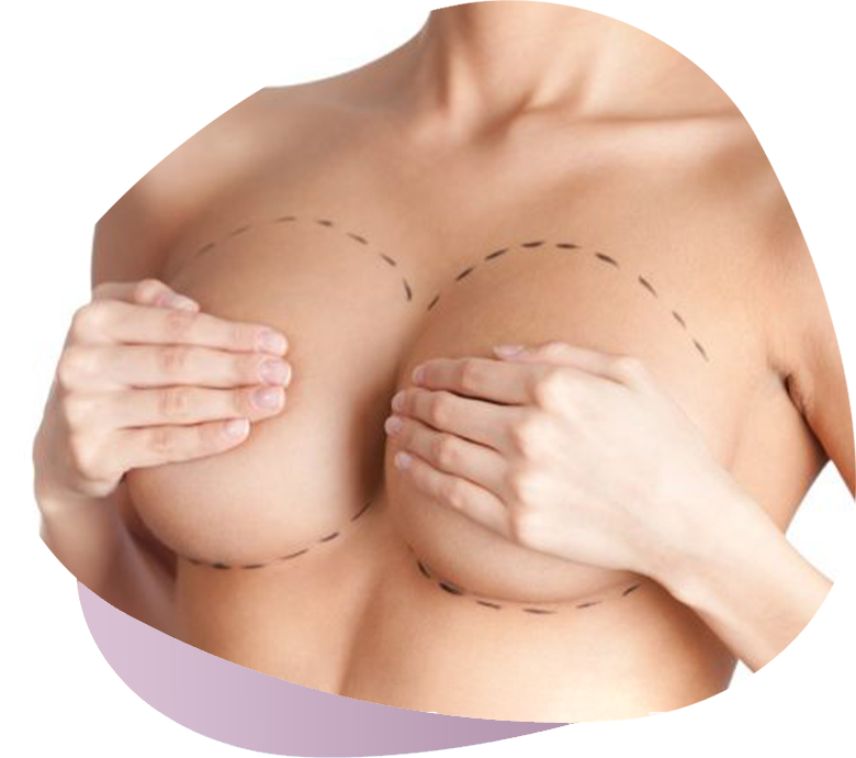 Breast Augmentation Surgery hsan T rkmen